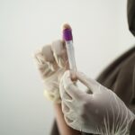 Trombosi venosa profonda: quali sono i sintomi e come intervenire?
